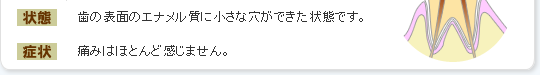 歯の表面のエナメル質に小さな穴ができた状態です。痛みはほとんど感じません。