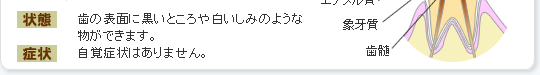 歯の表面に黒いところや白いしみのような物ができます。自覚症状はありません。